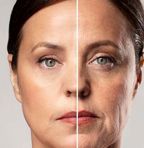 Tratamientos Antienvejecimiento